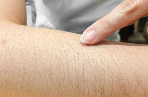 Bulu kelinci di Palangga, Konawe Selatan