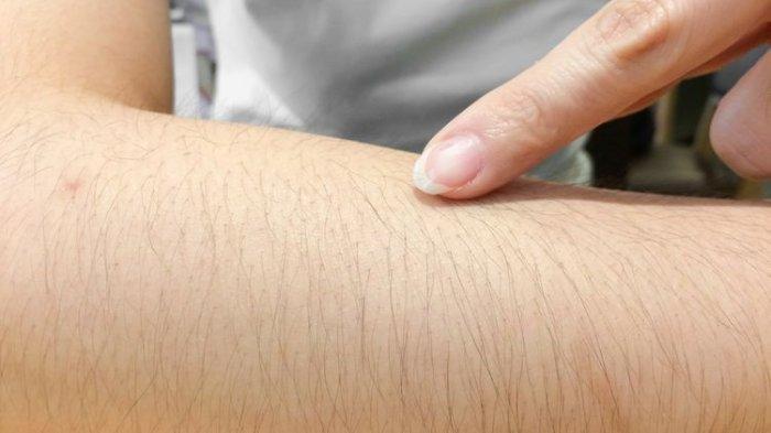 Bulu kelinci di Palangga, Konawe Selatan